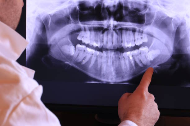 Best Emergency Broken Tooth Repair in Middleport, NY
